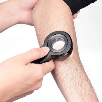 KÍNH LÚP SOI DA – CHÌA KHÓA KHÁM PHÁ LÀN DA ẨN GIẤU